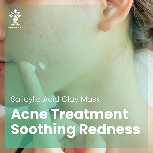 Miniatura 2 de AZ BIOTECH Máscara facial de arcilla de ácido salicílico para el acné, máscara para propenso al acné con vitamina C, glicerol aloe vera, vitamina E,