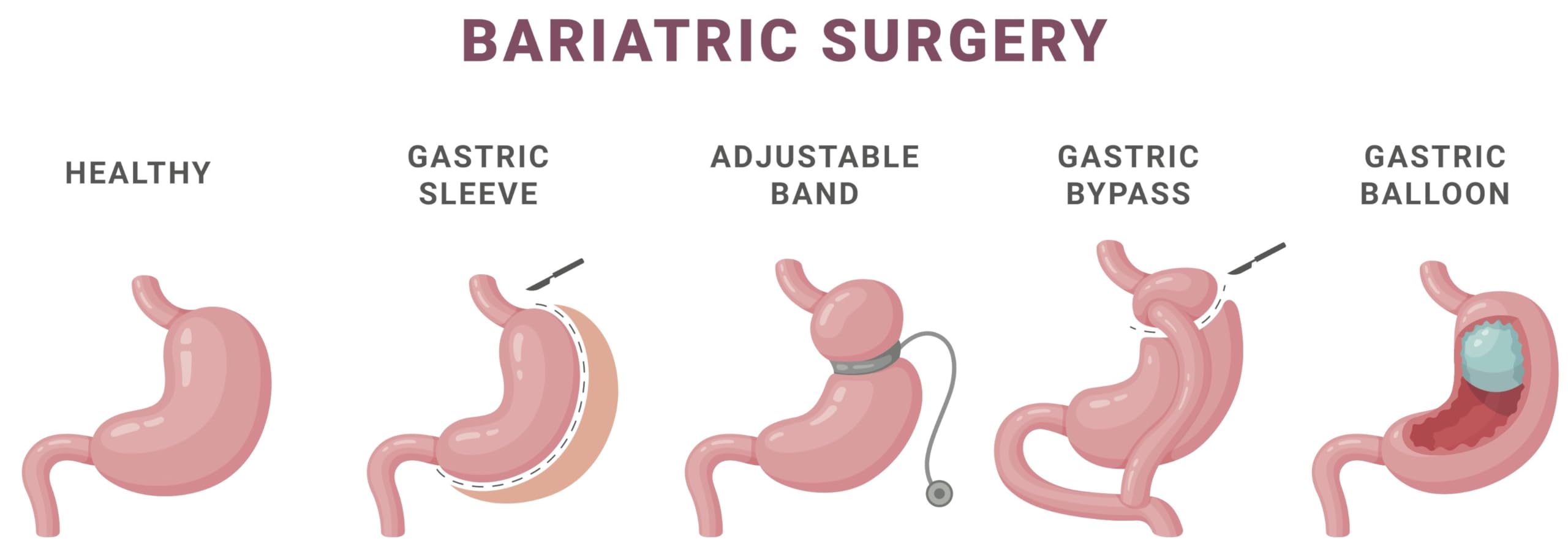 Gastroenterology Made Ridiculously Simple