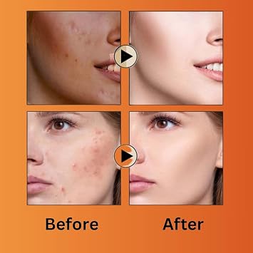 Miracle Beauty Papaya Face Wash Purifying Travel Size & Cleanser For Dark Circle For Women By Korean Technology | Face Wash Scrub | No Side-effect Free