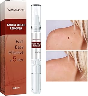 Wipe Off Tags & Moles Remover, Fast Easy Effective in 5 Days, Quick & Safe Remove, Skin Tags Moles Remover Pen, Liquid Mole Removal Pen for All Body Parts