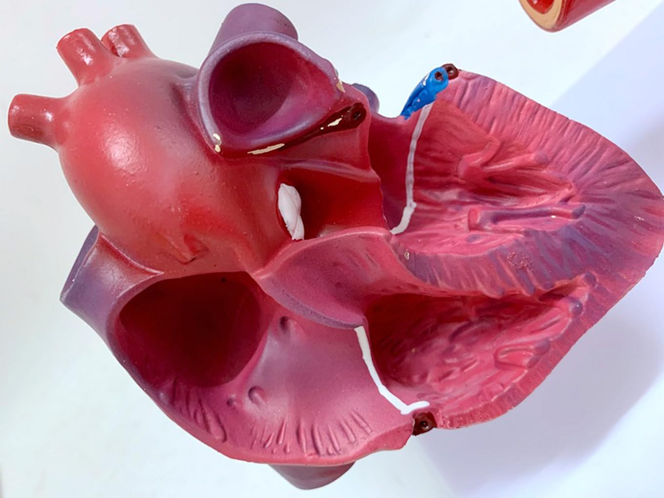 Narzędzia do nauki modelu, nauczanie anatomii serca serca pomostowanie tętnic wieńcowych model z blokadą tętnic i naczyń krwionośnych zakrzepica pomoce dydaktyczne