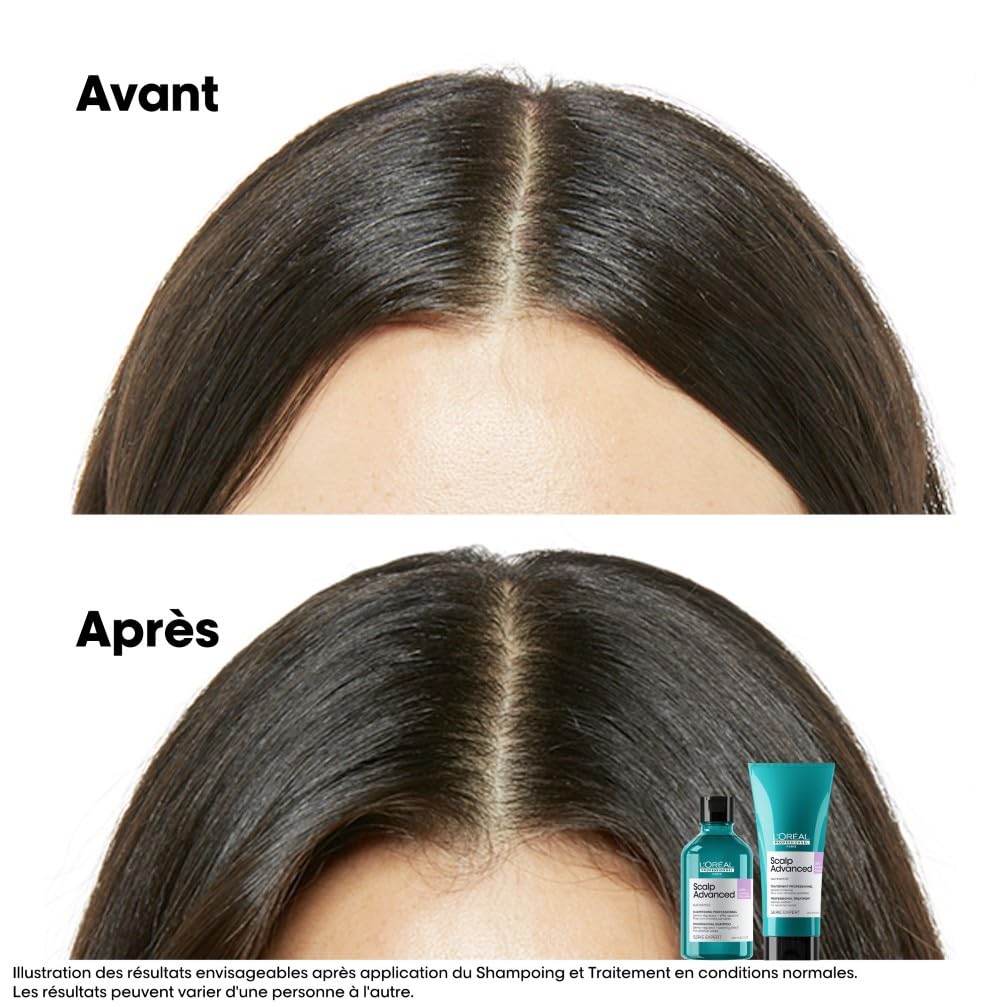 L'OREAL PROFESSIONNEL - Scalp Advanced Anti-Inconfort & Démangeaisons - +83% d'Apaisement du Cuir Chevelu et +49% d'Hydratation - Dermo-Régulateur pour Cuirs Chevelus Sensibles - Sans Silicone