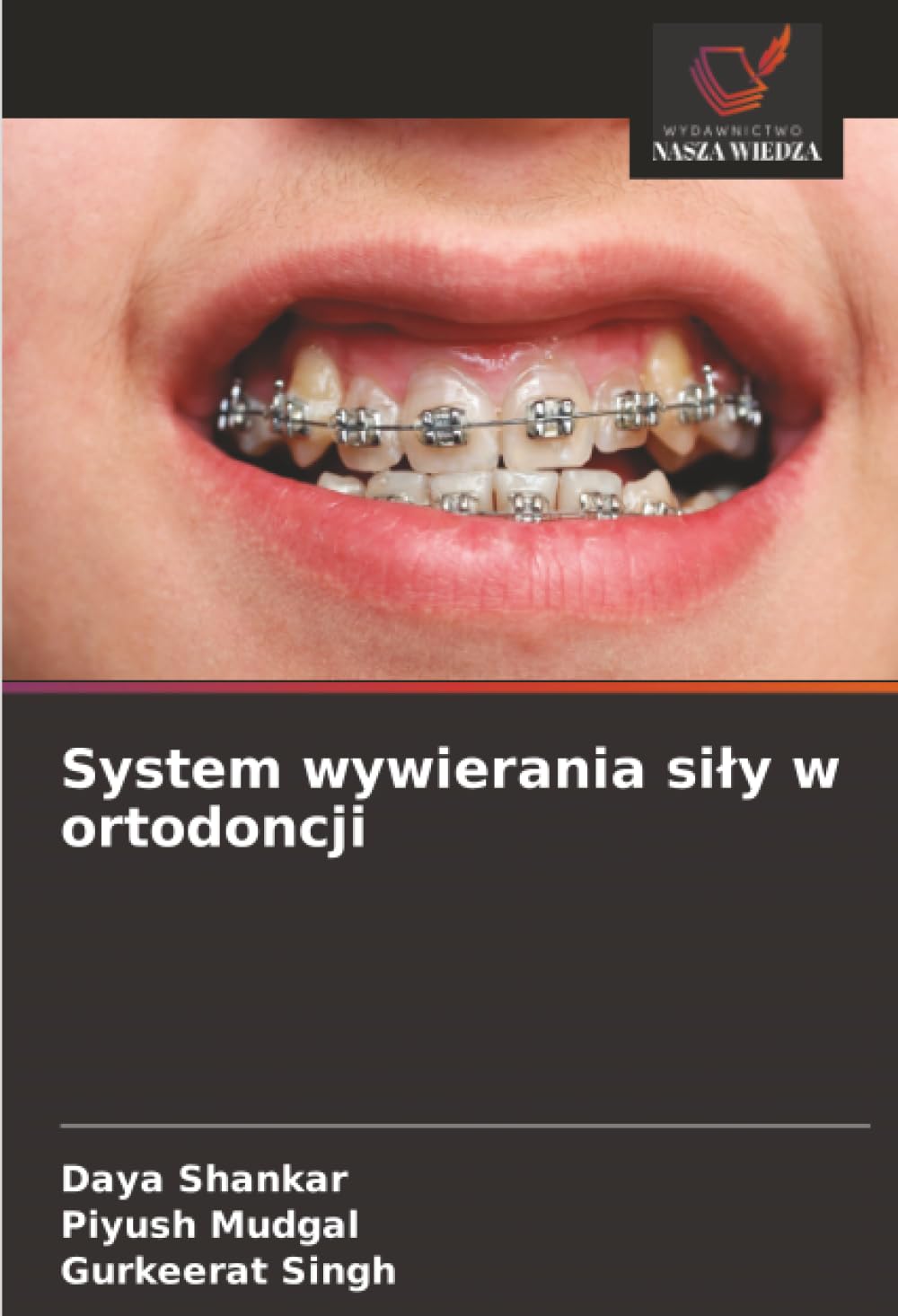System wywierania si¿y w ortodoncji
