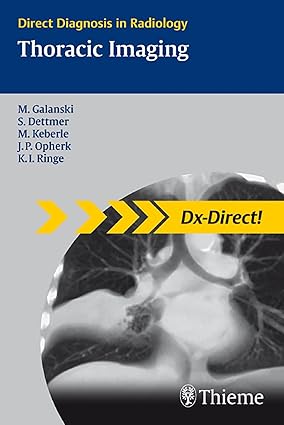 Direct Diagnosis in Radiology  Thoracic Imaging-Wow! eBook