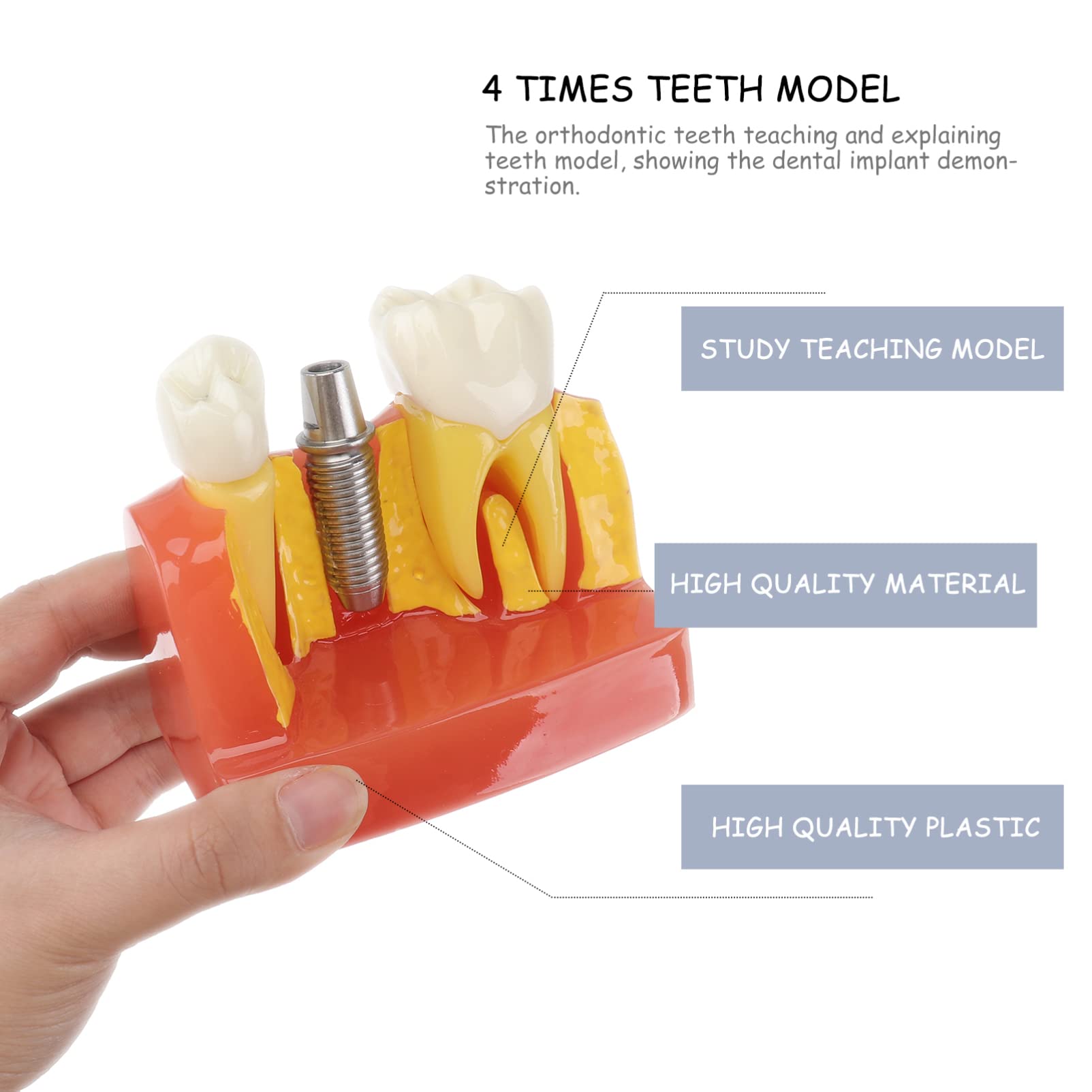 OUNONA 1pezzi Modello di Denti Didattico Rimovibile per Strumento Educativo per Lezioni di Odontoiatria Modello di Studio con Denti e Protesi