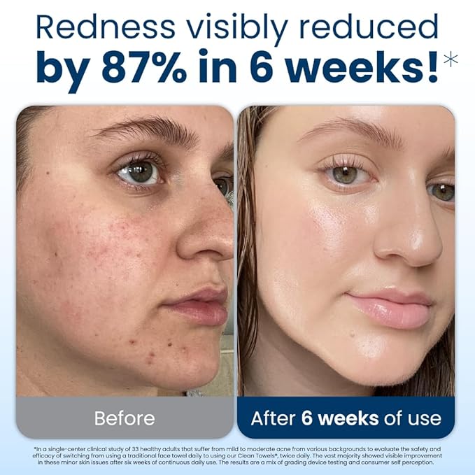 Clean Skin Club Clean Towels XL Ultra Soft Disposable Face Towelette Face Towel Eczema Association Accepted