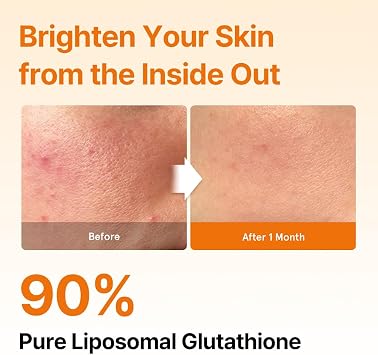 glutathione cause high blood pressure Is Glutathione Safe for High Blood Pressure? Exploring the Antioxidant's  Role