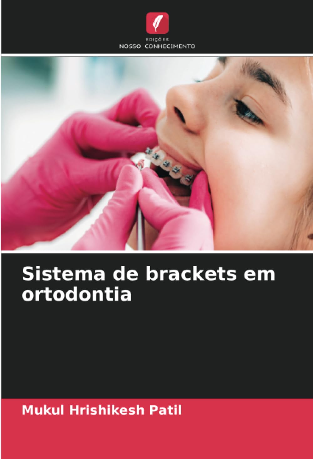 Sistema de brackets em ortodontia