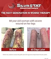 Vista 7 de SilvrSTAT First Aid Kit Gel, 32 PPM Silver Healing Wound Dressing Solution, SilverSol Ag₄O₄ Particles, 3 oz