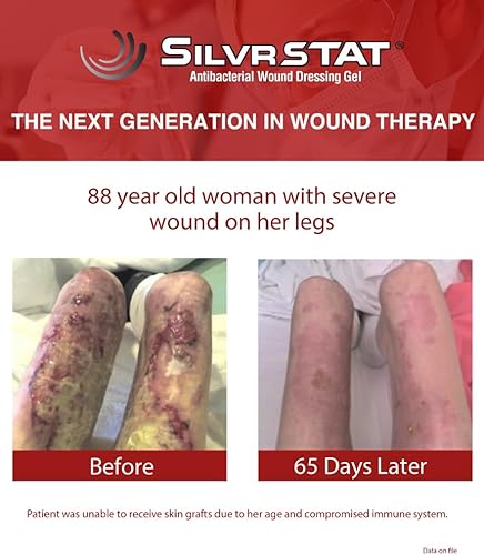 Miniatura 7 de Kit de primeros auxilios Gel  Solución de curación de heridas de plata de 32 PPM  Partículas SilverSol Ag4O4  3 onzas