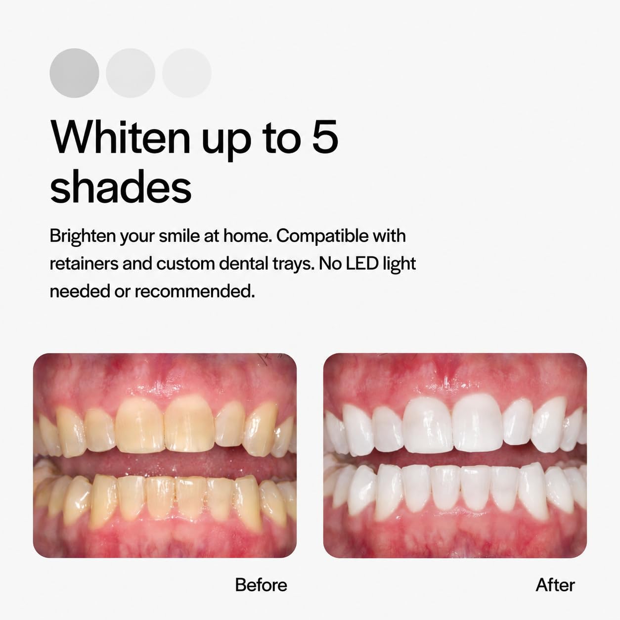 Opalescence 10% Teeth Whitening Gel - Refill -4