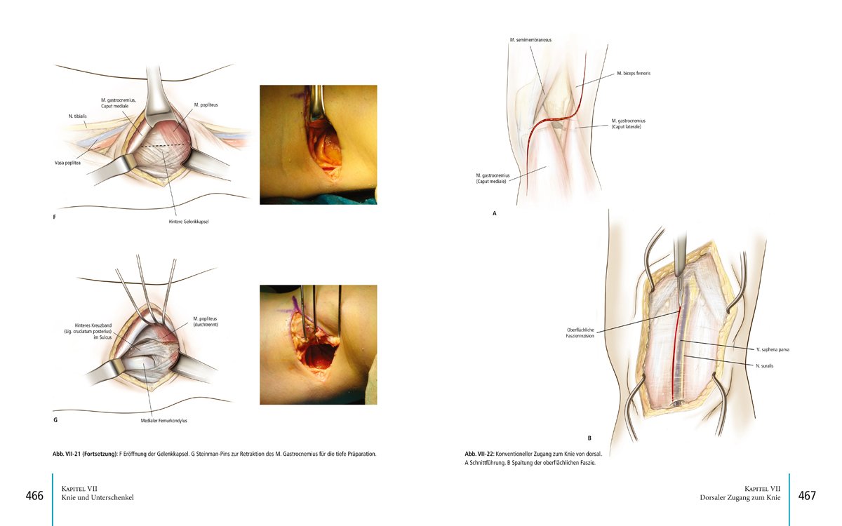 Bildatlas operative Zugangswege: Orthopädie | Unfallchirurgie (inkl. englischsprachiger DVD)