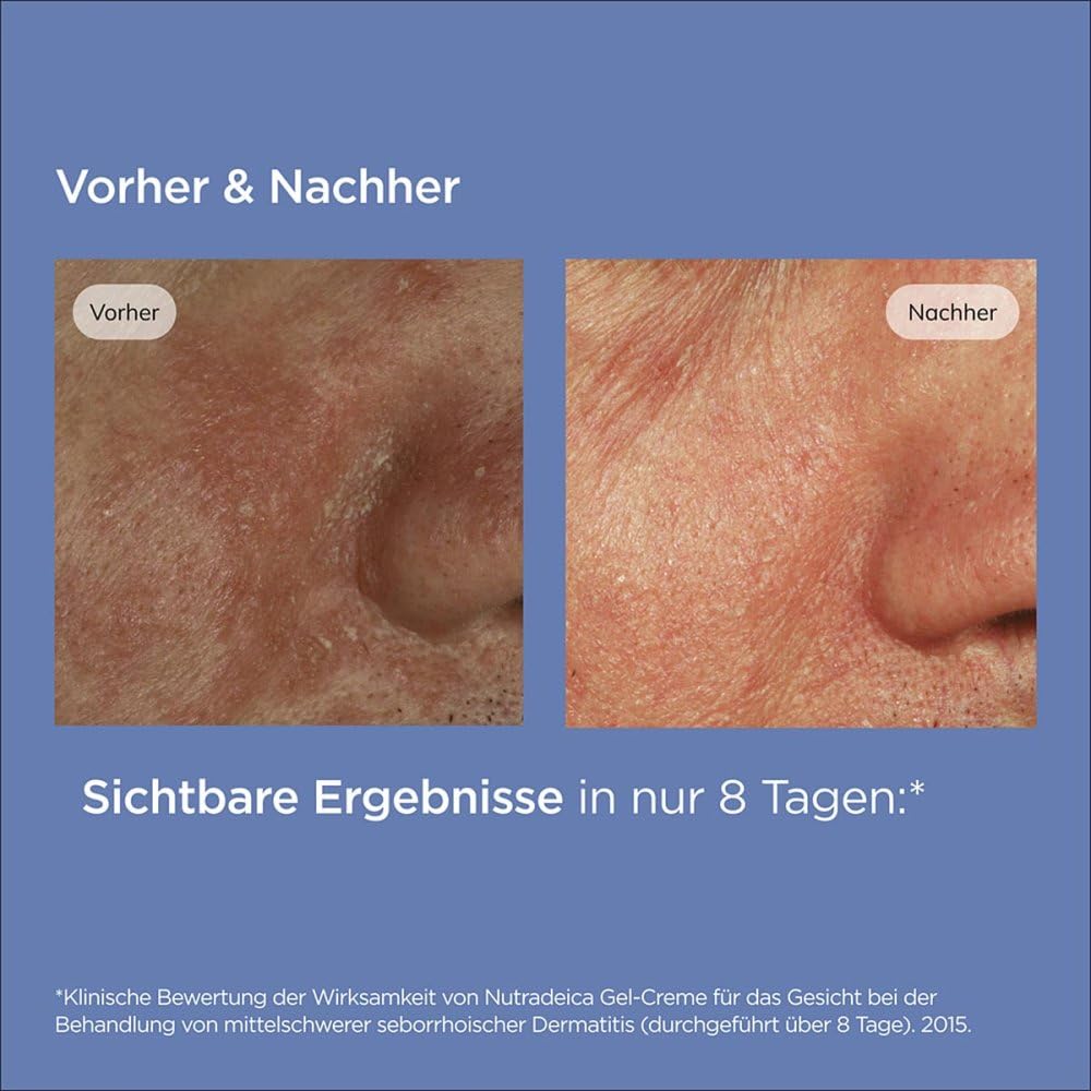 ISDIN Nutradeica Seborrheic Skin Gel Crema Viso (50 ml) | Idrata, Lenisce e Opacizza | Per Pelli a Tendenza Seborroica | Uso Quotidiano