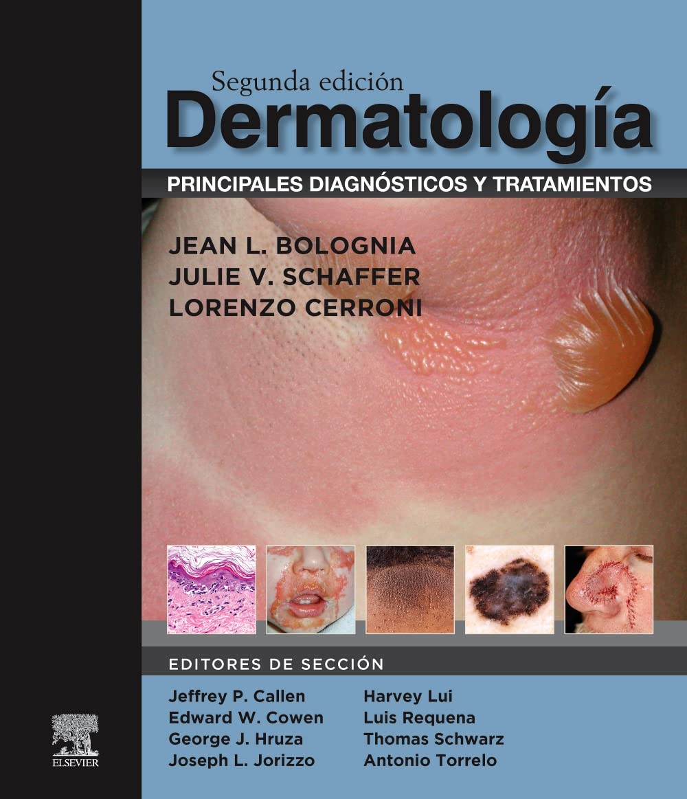 Dermatología: principales diagnósticos y tratamientos, 2.ª Edición