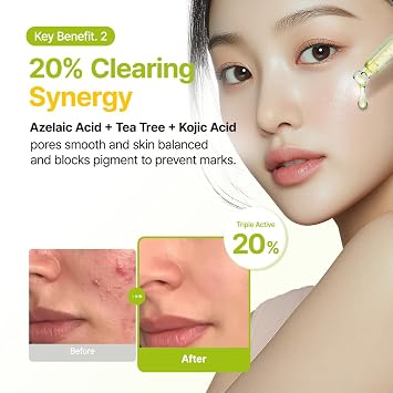 PURITO Azelaic 10% Kojic Serum for Sensitive Skin, 1.01 fl.oz