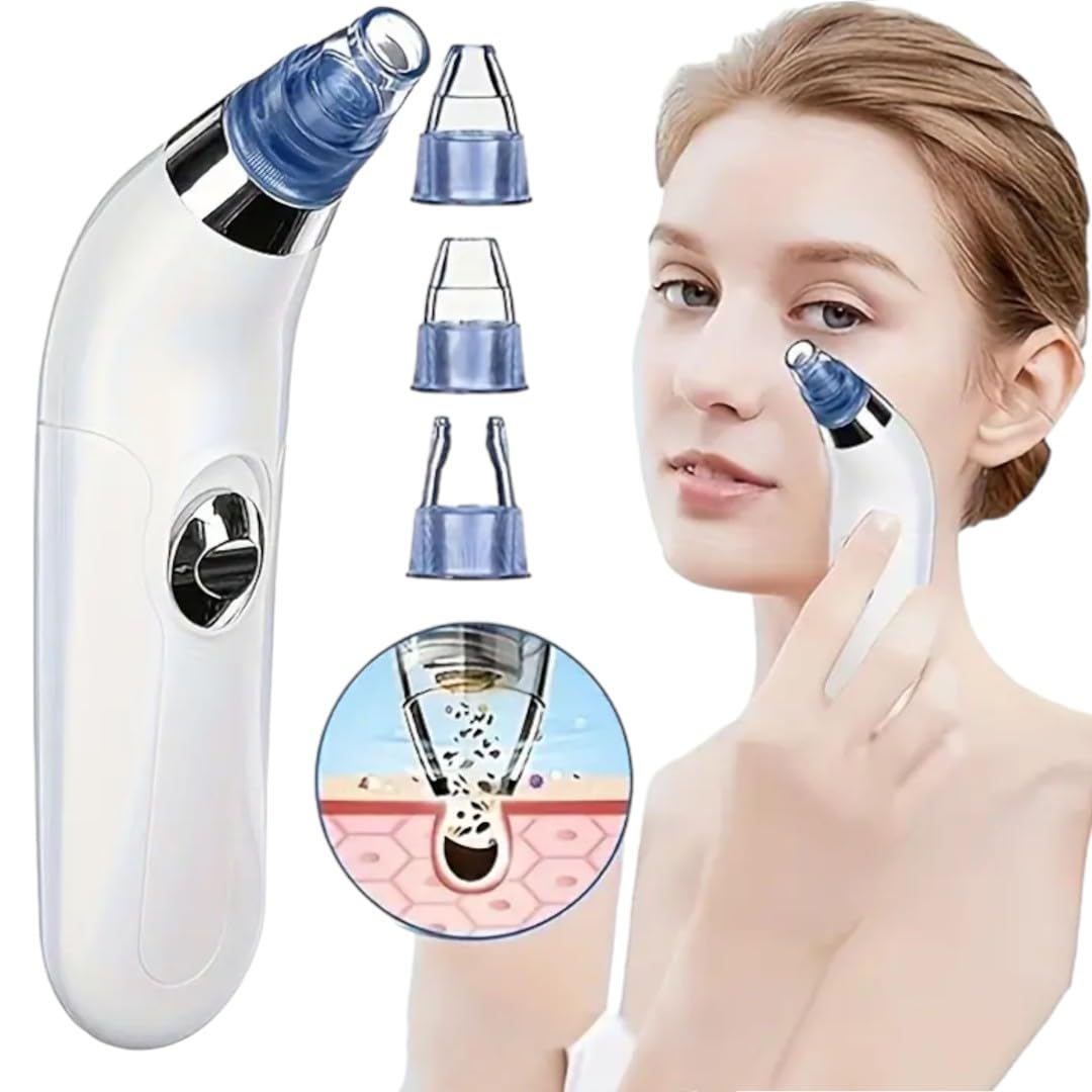 TLISMI 4-in-1 Blackhead Remover Kit Flawless Cleanser with 4 Suction Heads Gentle & Effective Blackhead Extractor Multifunction Black Head Sucker for Men & Women Electric Facial Cleansing Device