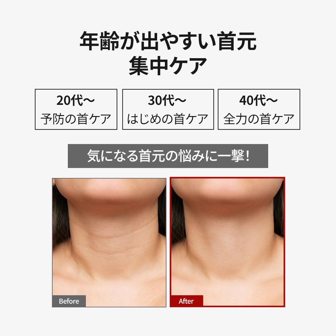 Amazon | 【公式 MEDIPEEL】メディピール ネッククリーム スキンケア
