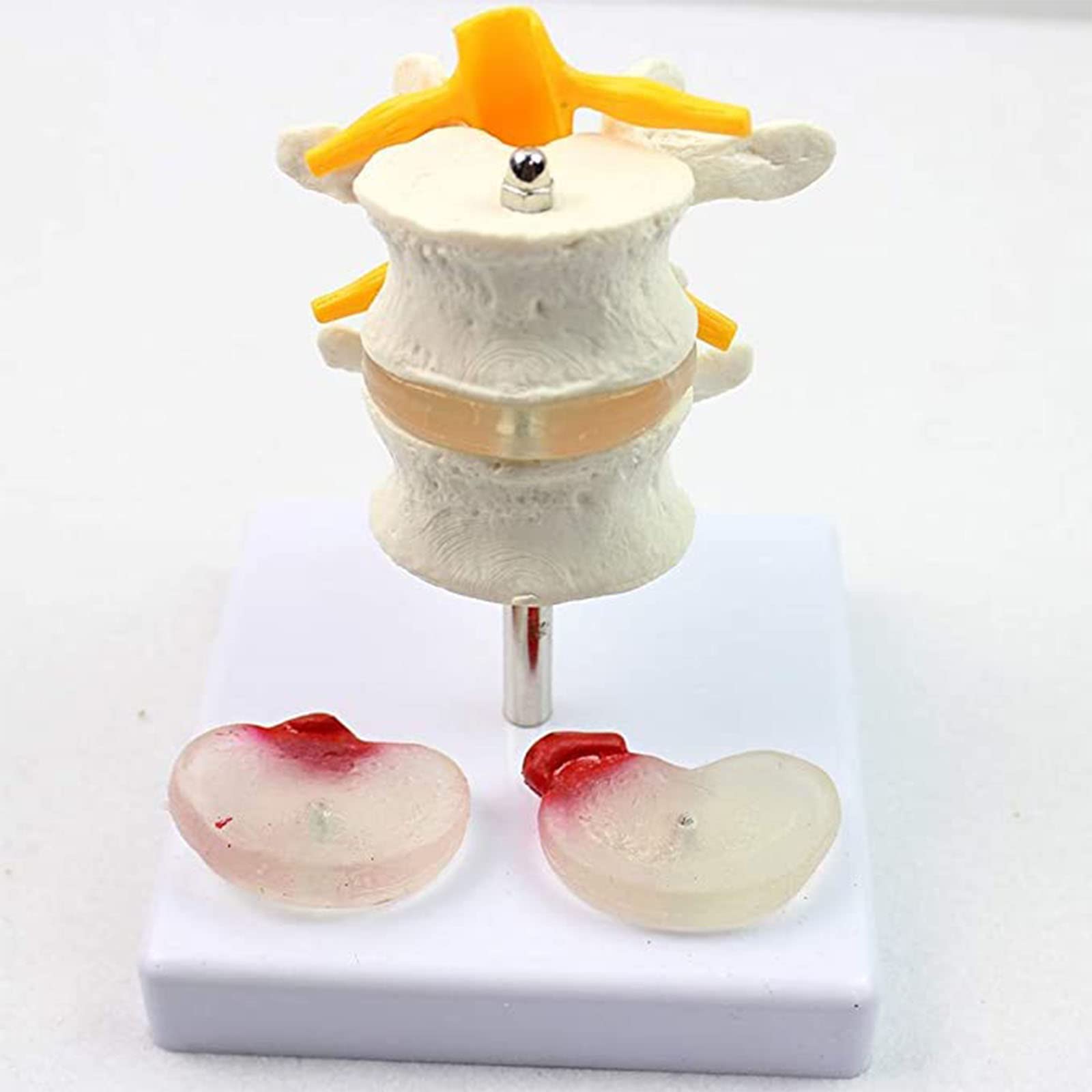GTHTUHFD Educational Model Skeletal Model Of Diseased Intervertebral Disc Model Human Lumbar Spine Model Human Spine Model