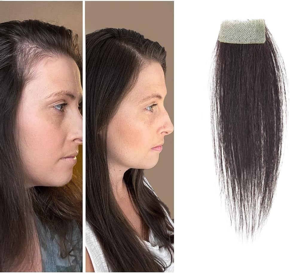 scar human hair replacement Accidental burns without hair for men women Hairline Loss Straight Tape in Replacement Toupee (Natural Black, 0.78"x1.5")