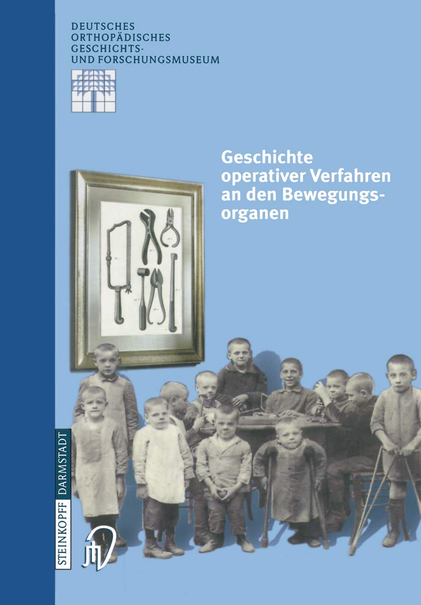 Geschichte operativer Verfahren an den Bewegungsorganen (Deutsches Orthopädisches Geschichts- und Forschungsmuseum (Jahrbuch), 2) (German Edition)