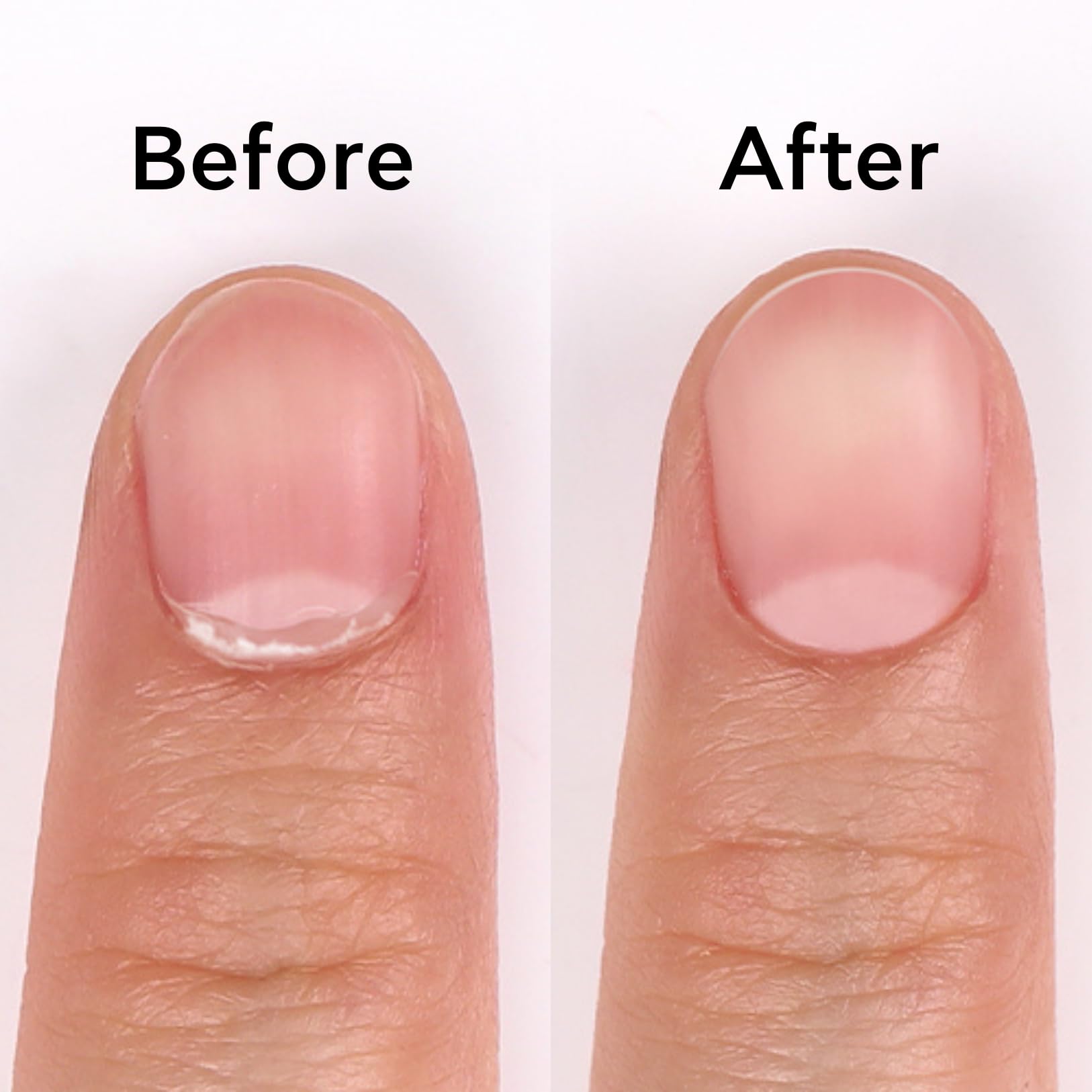 Bluesky Solvente per Cuticole 30g, Acido Ialuronico e Camomilla, Ammorbidente Pelle Morta ad Azione Rapida 15 Secondi per Preparazione Manicure Gel e Acrilico