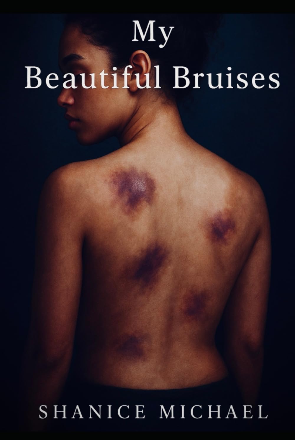 My Beautiful Bruises