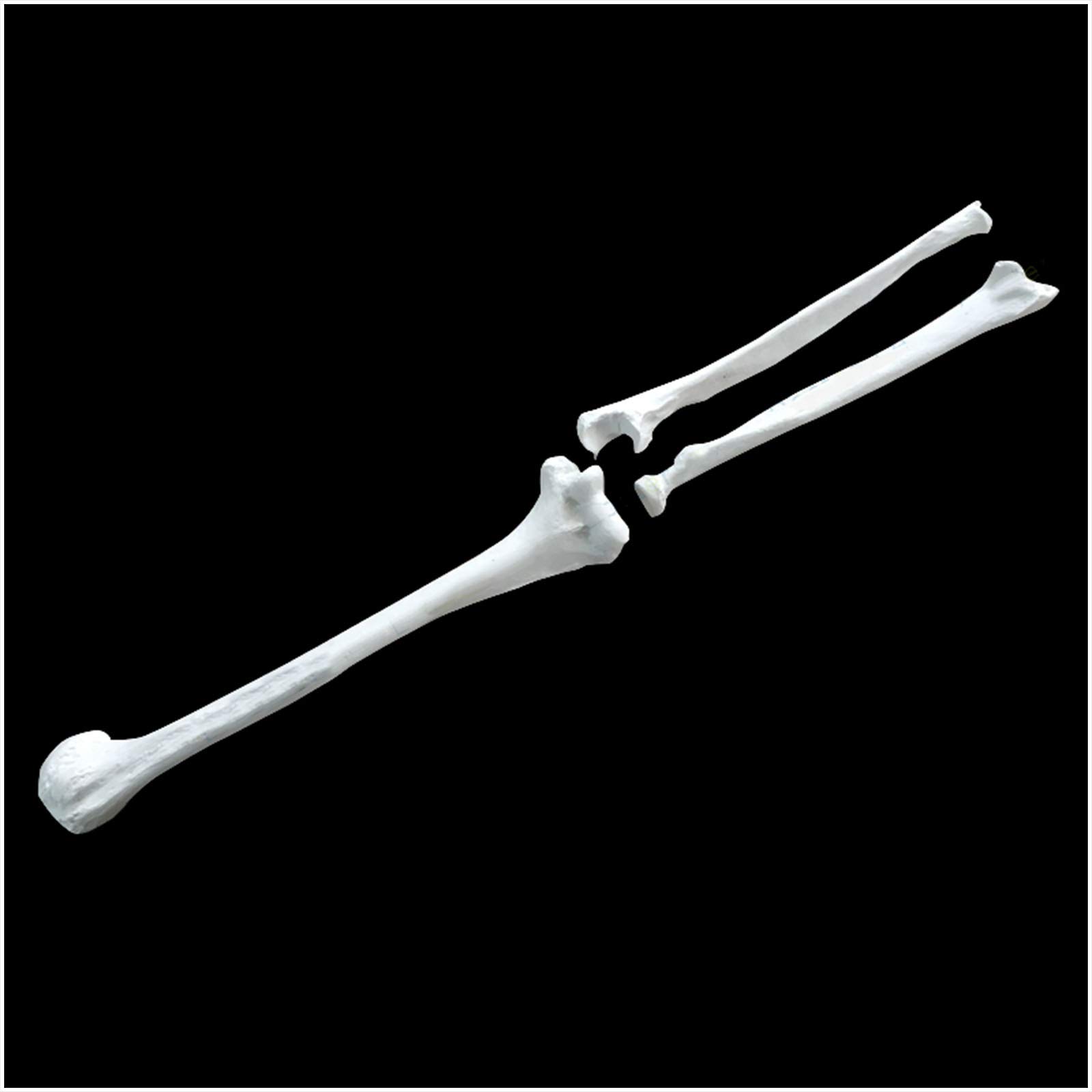 Sjdopulse A Human Upper Limb Bone Model - Natomy Model Human Humerus Nd Uln Radius Model - Pvc Material Simulation Human Bones Model - For Study Teaching (A)