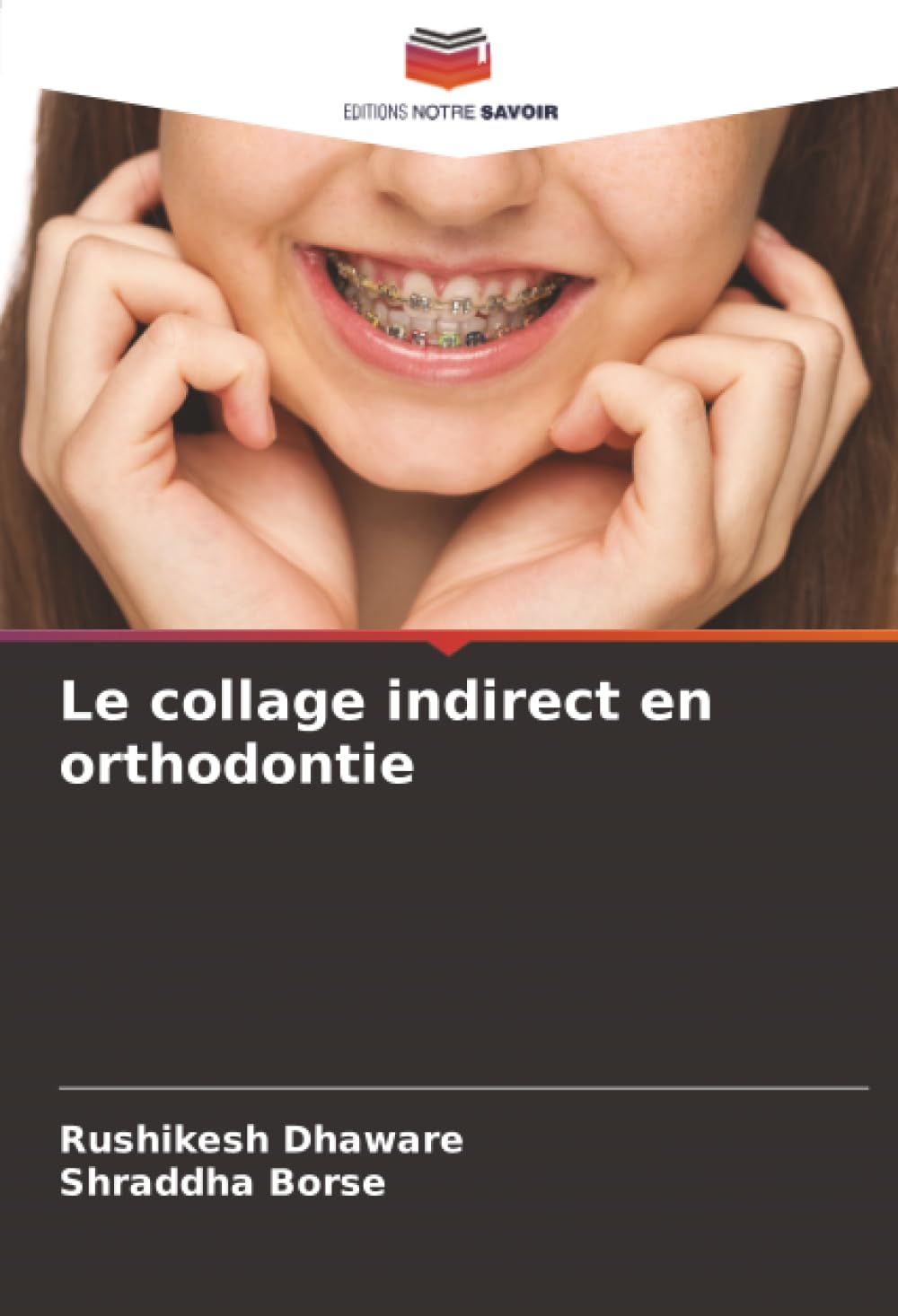 Le collage indirect en orthodontie