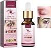 Stye EyeTreatment,MyceliaBlepharitis,RelievePuffinessSerum,Eye Drops for Infected Eyes for StyesChalazion&Blepharitis,Daily Cleanser For Dry Eye Relief 30ml