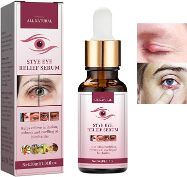 Stye Eye Treatment for Styes Chalazion&Blepharitis,Relieve Puffiness Serum