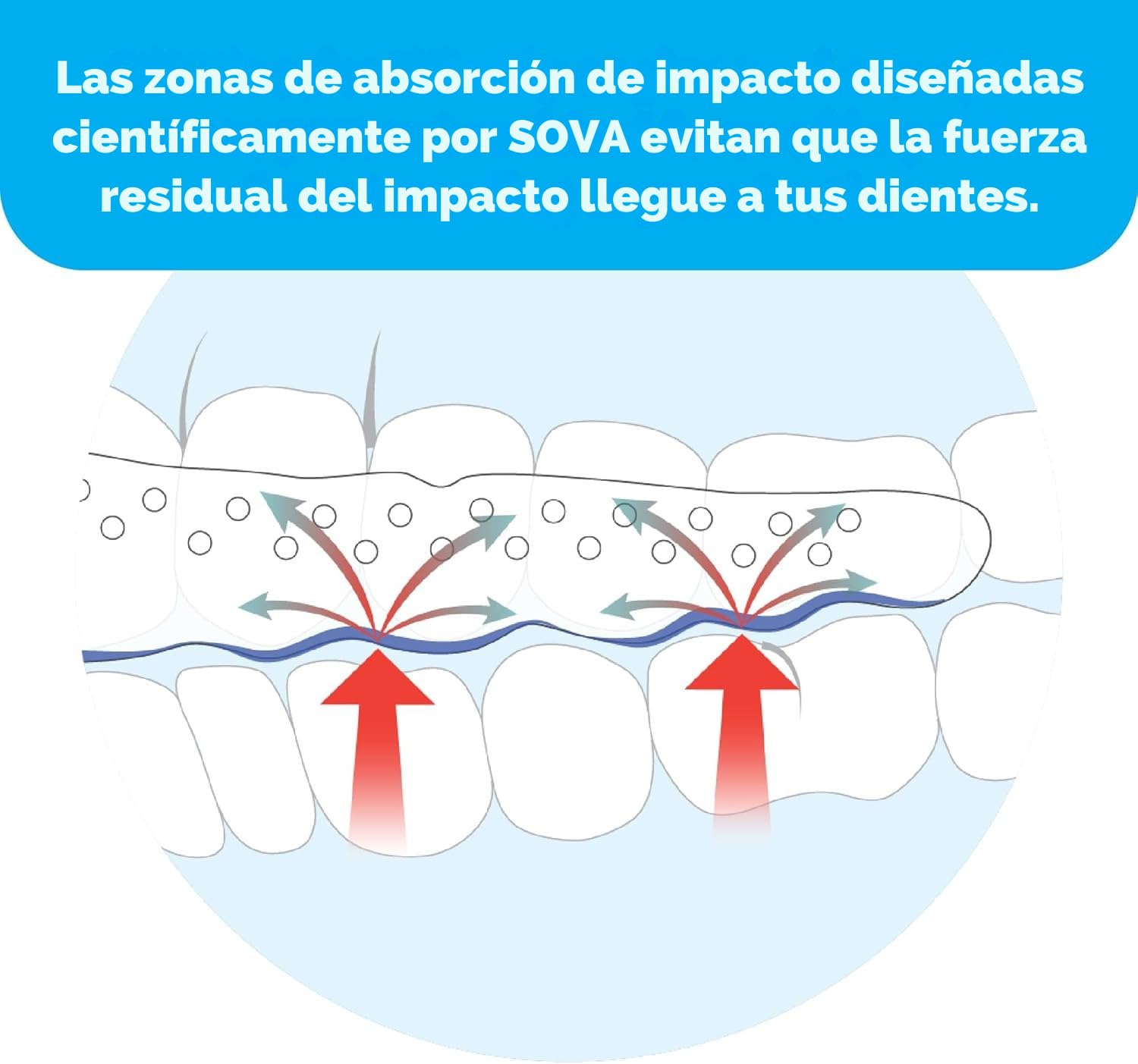 Protector Nocturno SOVA Aero - Férula nocturna para el Rechinamiento de Dientes/Bruxismo - Protector Bucal Personalizado - 1.6mm - Adaptable y Remoldeable hasta 20 Veces - Para Adultos - Con Estuche