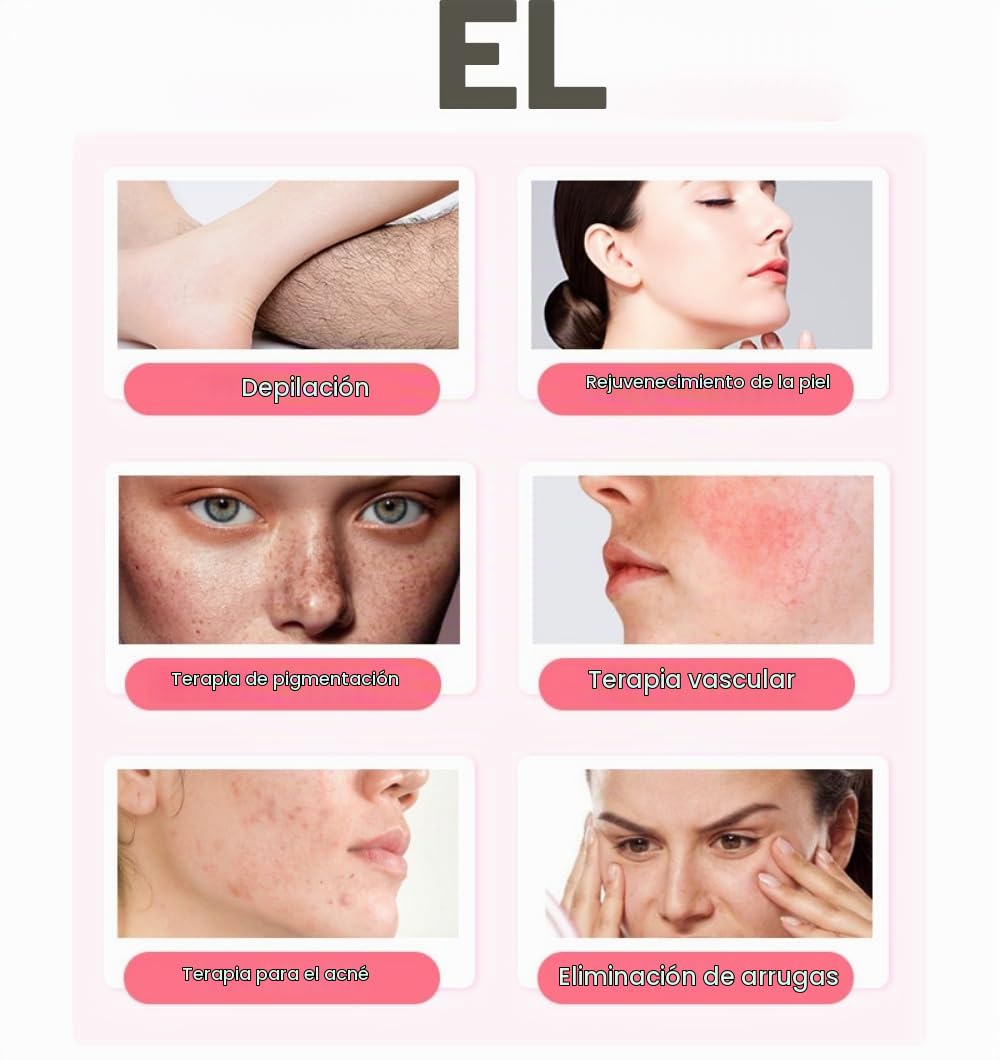 Dispositivo de Belleza Multifuncional Con Luz Pulsada Intensa OPT: Depilación IPL, Rejuvenecimiento Facial y Tratamiento de la Pigmentación y el Acné
