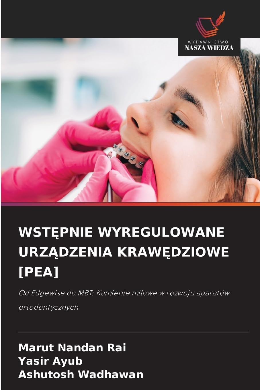 WST¿PNIE WYREGULOWANE URZ¿DZENIA KRAW¿DZIOWE [PEA]: Od Edgewise do MBT: Kamienie milowe w rozwoju aparatów ortodontycznych