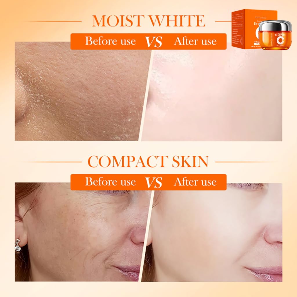 Vitamin C Face Cream, Moisturiser Face Women with Hyaluronic Acid & Vitamin C - Image 2