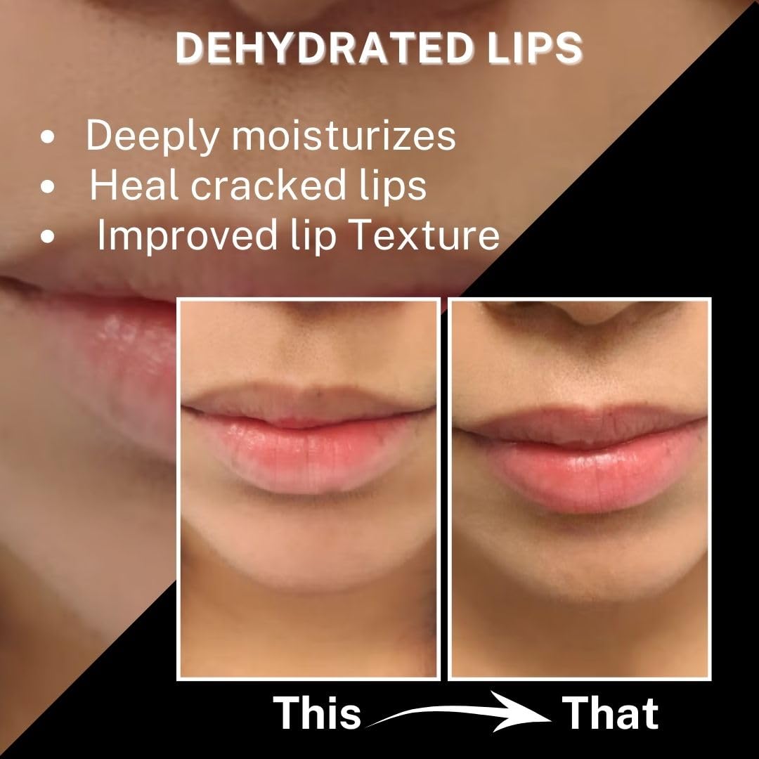 HOUSE OF BEAUTY Lip Color Corrector Serum | Enriched with Pomegranate, Hemp Seed & Apricot | Lip Pigmentation | Unisex (10ml) - Image 7 thumbnail