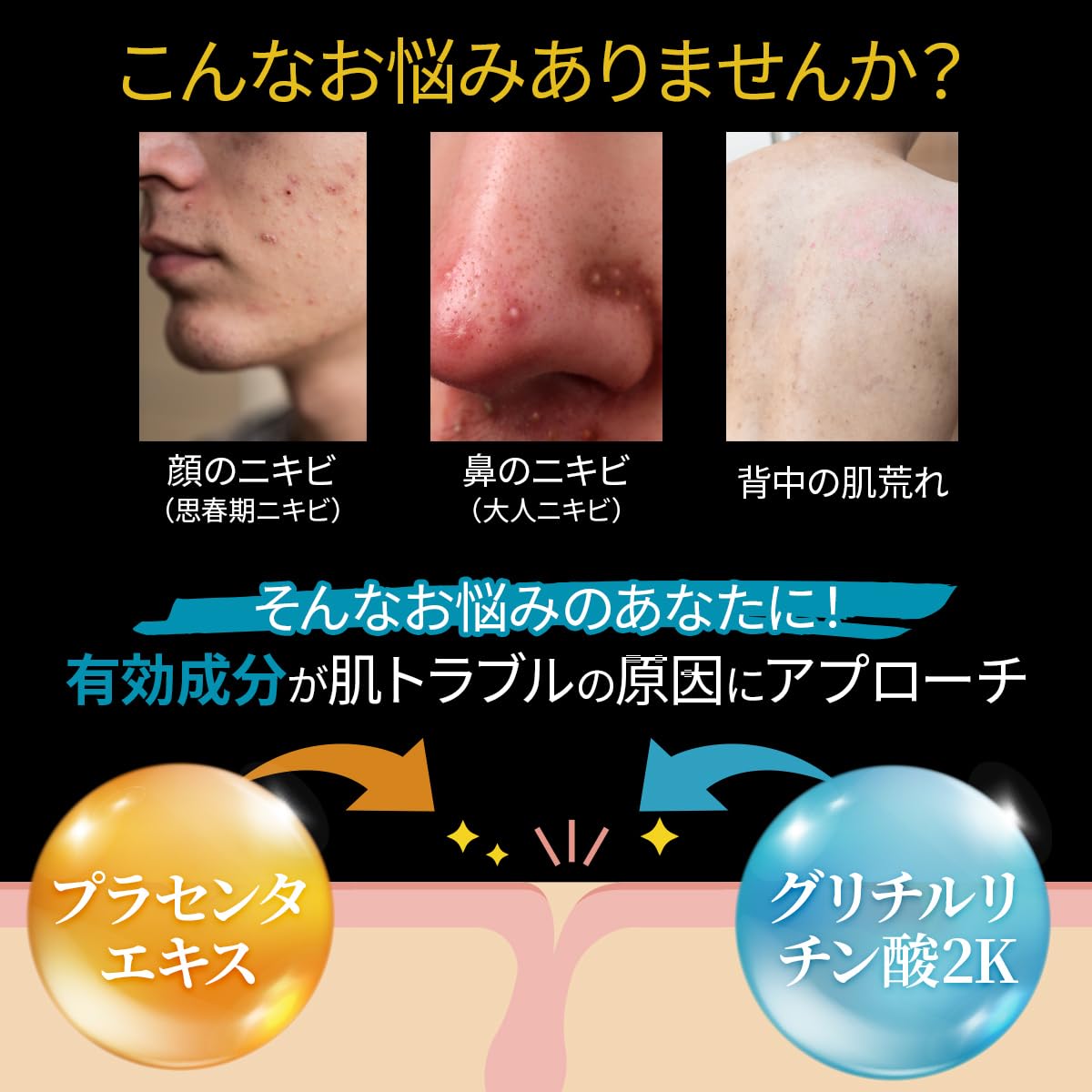 Amazon.co.jp: [インクレイ] INCLAY 大容量 薬用 白い泥パック メンズ