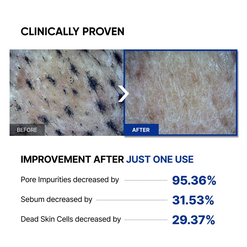 Microbiome Renewing Cream Mask, Wash-off Face Mask, Cream Exfoliating, Pore Care, Glass Skin Effect, Barrier-Friendly Korean Skincare | 3.38 fl.oz. (100ml)