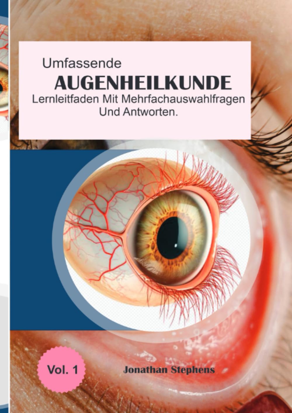 Umfassender Lernleitfaden für Multiple-Choice-Fragen und Antworten zur Augenheilkunde