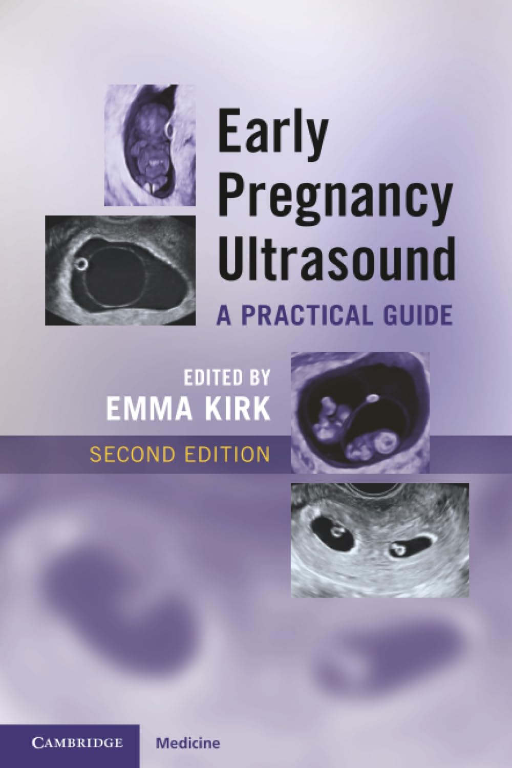 Early Pregnancy Ultrasound: A Practical Guide