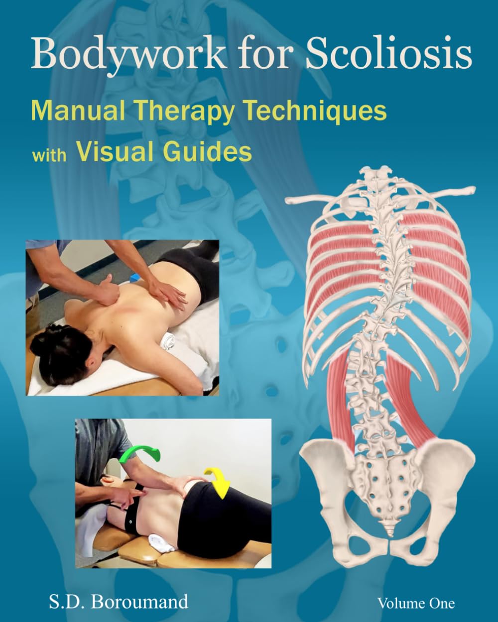 Bodywork for Scoliosis: Manual Therapy Techniques with Visual Guides | Massage Therapy for Scoliosis | Visual Guides for Scoliosis | Hands-on ... for Scoliosis | Scoliosis Illustrations      Paperback – December 4, 2025