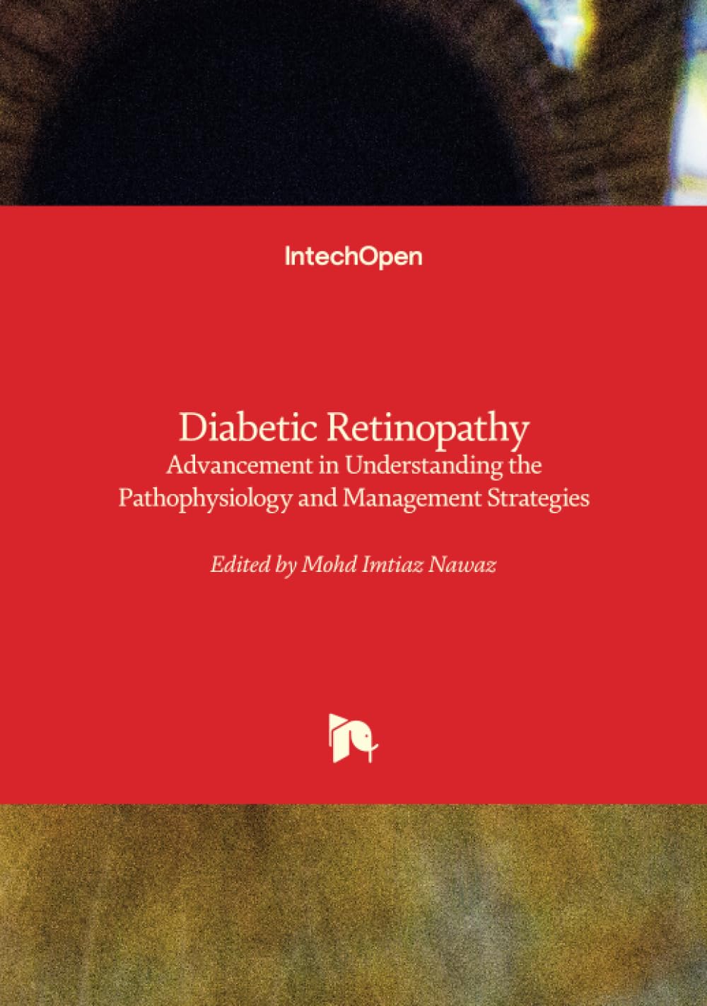 Diabetic Retinopathy - Advancement in Understanding the Pathophysiology and Management Strategies