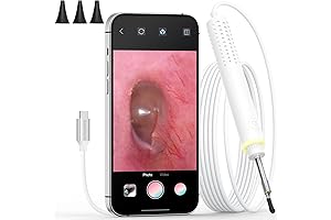 ScopeAround Ear Wax Otoscope: Revolutionizing Ear Cleaning