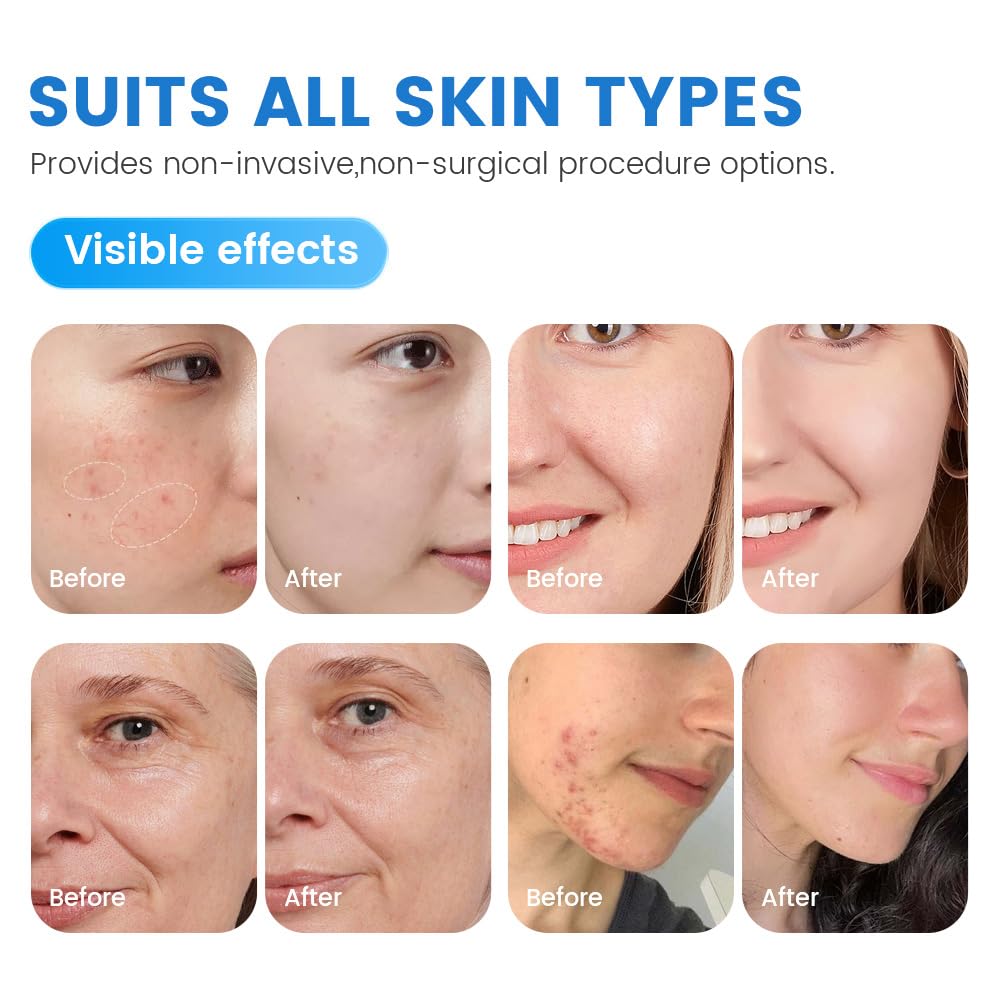 Dispositivo profesional 7 en 1 para la limpieza facial, herramienta de belleza hidratante y regeneradora de la piel, limpia profundamente, hidrata y reafirma la piel del rostro, color negro y dorado.