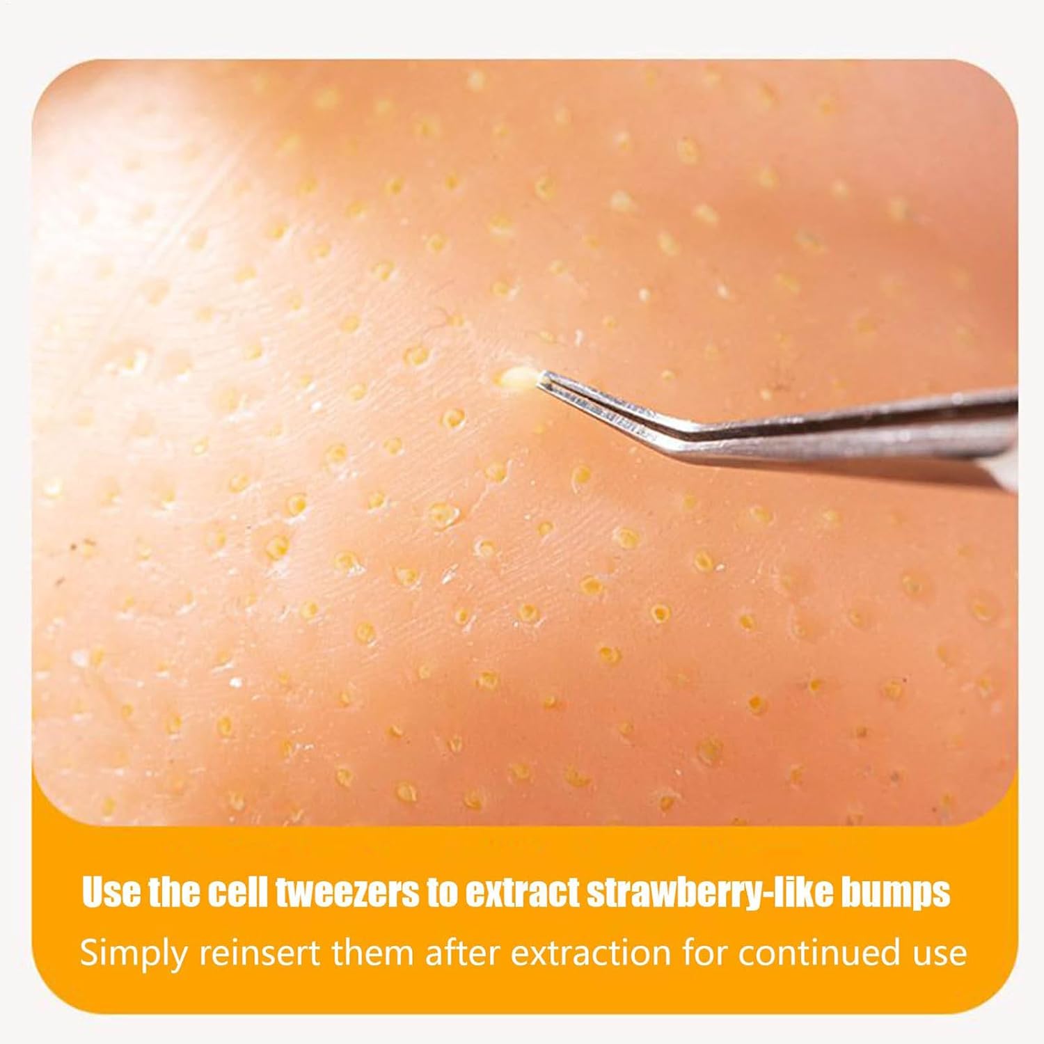 Popping Toy, Silicone Pimple Popping Funny Gag Gift Realistic Blackhead Squeezing Toy for Stress & for Classroom Office Management Tool