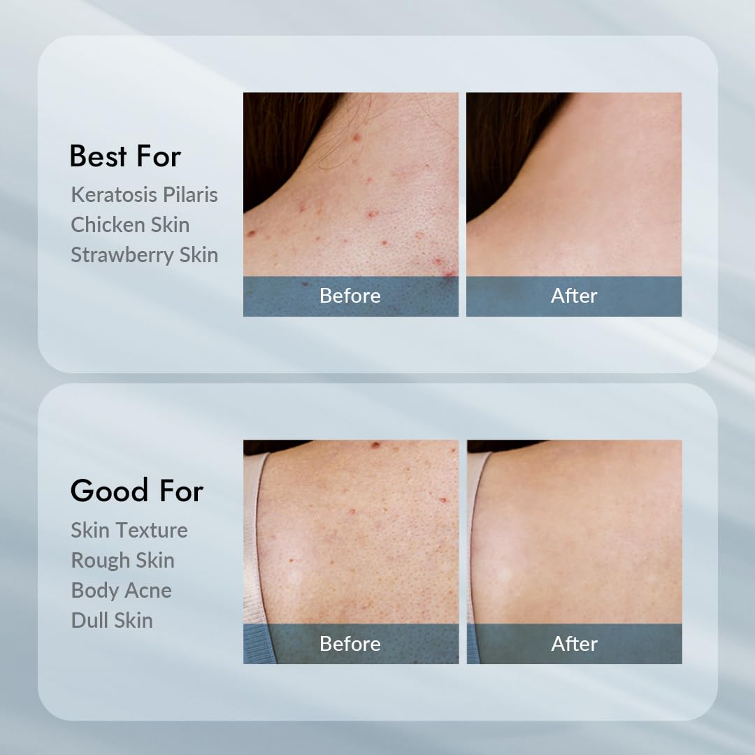 V11FACTORY AHA 12% Glycolic Acid Body Lotion – Korean Exfoliating & Hydrating Body Cream with Hyaluronic Acid & Collagen – Unscented, Paraben-Free Skin Smoothing Moisturizer, 10.6 oz - Image 7