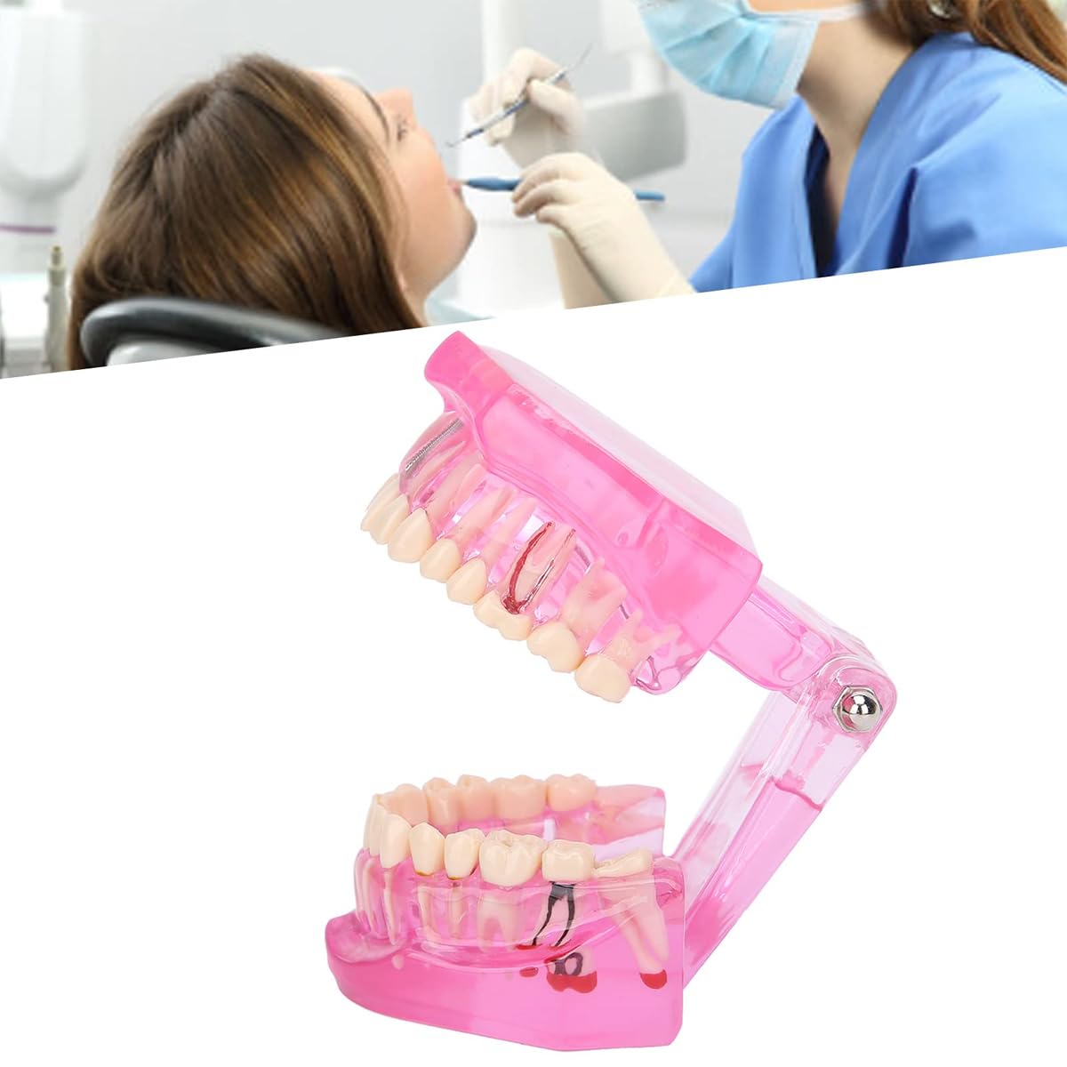 Ubric Modèle d'enseignement dentaire - Modèle oral amovible compatible avec l'enseignement, la recherche et les laboratoires dentaires (rose)