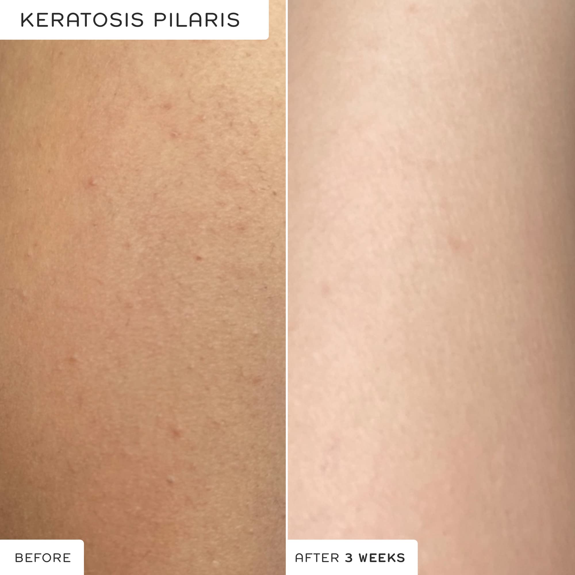 Buy REN Clean Skincare AHA Body Serum Lactic Acid for Gentle