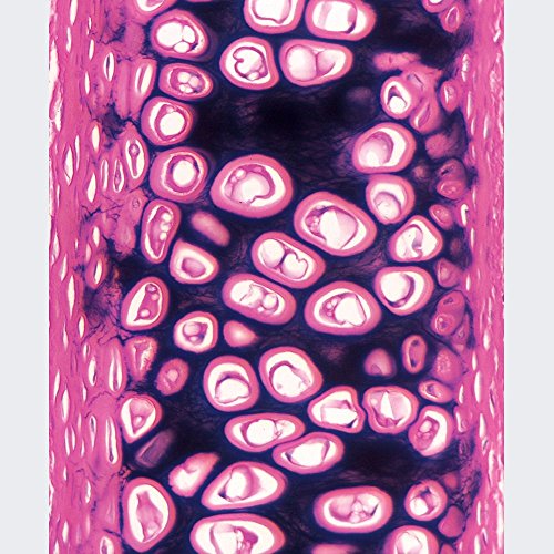 Mammal Elastic Cartilage, sec. 7 m Verhoeff's stain, Microscope Slide