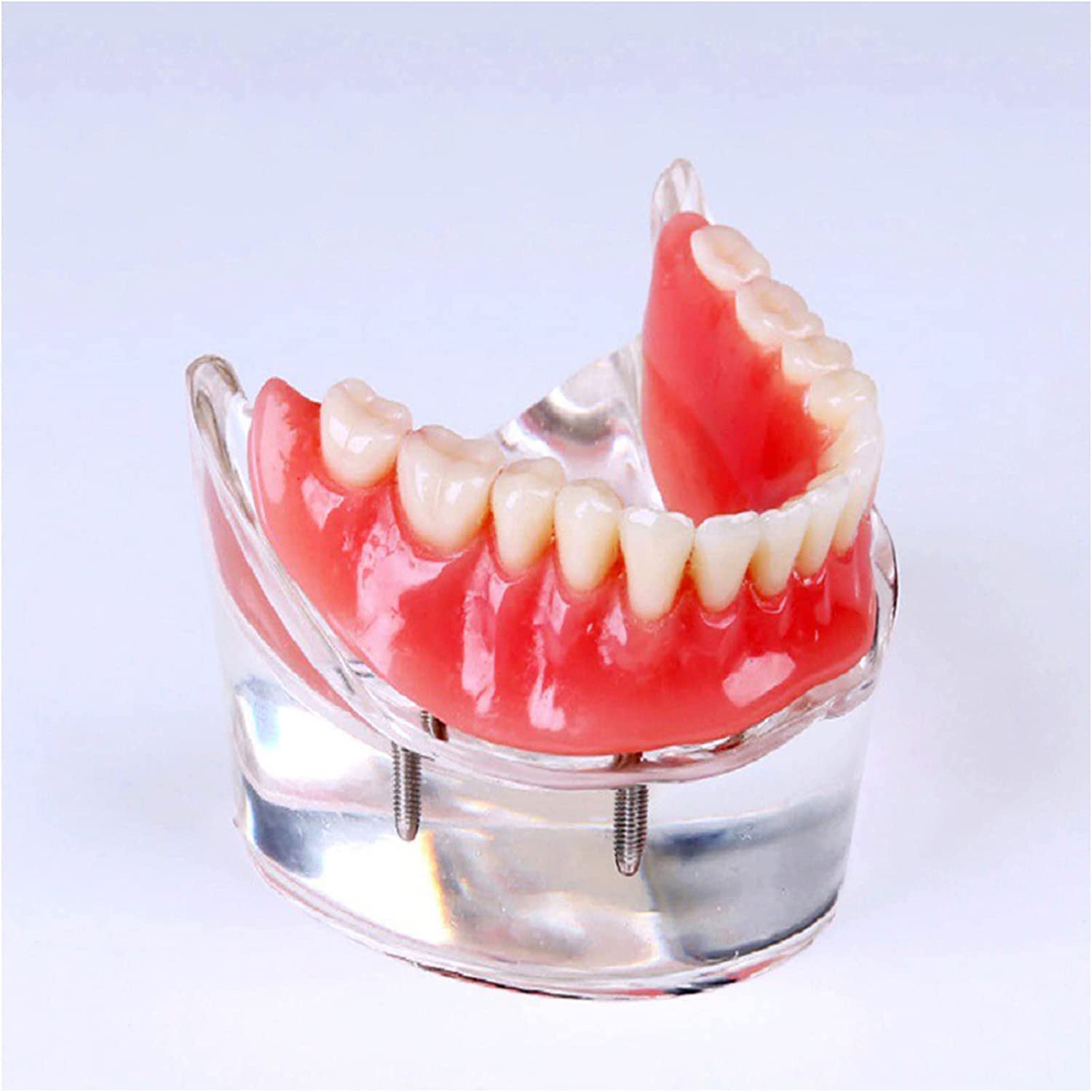 Modello Anatomico, Modello Scheletrico, Modello di Denti Implantari, Modello Didattico per Studio Odontoiatrico, per Protesi su Impianti E Unghie, Modello di De