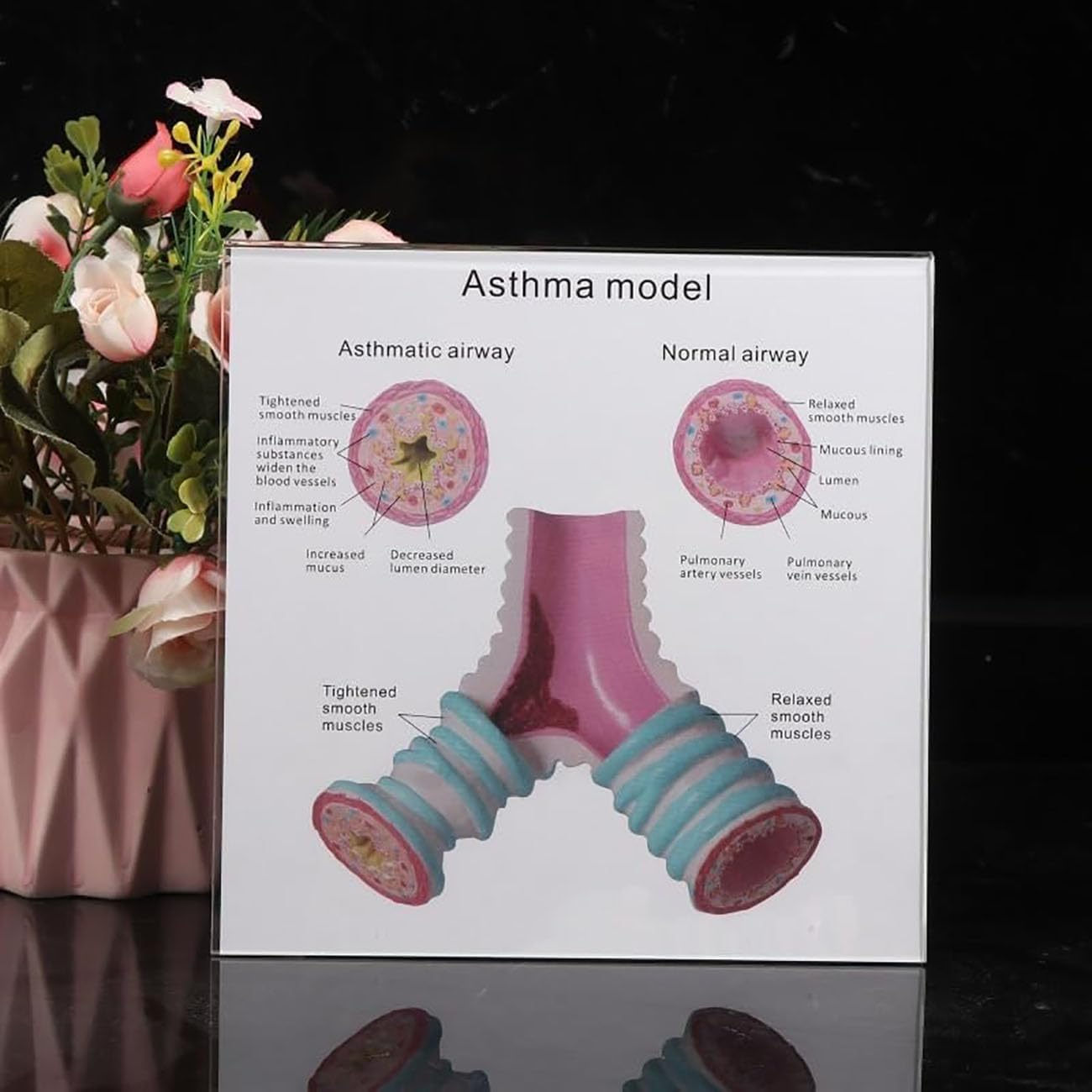 Human Asthma Anatomy Model, Human tracheal case Model,Respiratory System Bronchial Model for Students Study Display Teaching Model